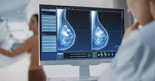 Mammography | Mammography is specialized medical imaging that uses a low-dose x-ray system to see inside the breasts. A mammography exam...